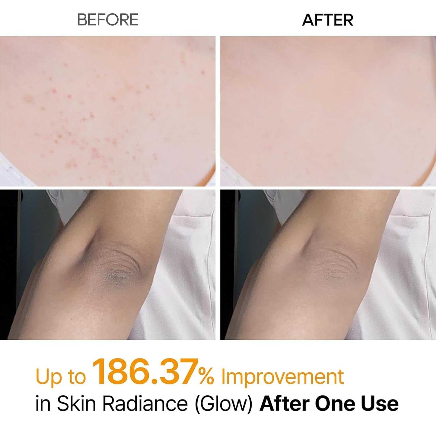 NOVADERM Body Peeling Spray for glowing skin shows visible exfoliation results with smoother, clearer skin after one use. Ideal for dull or rough areas.