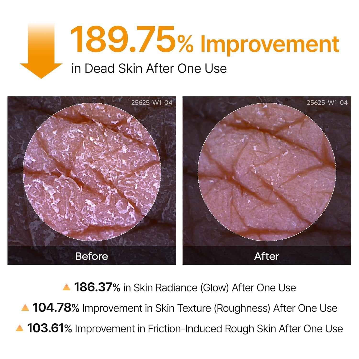 NOVADERM Body Peeling Spray - body peeling spray for glowing skin showing 189.75% improvement in dead skin removal after one use with before and after skin close-ups.