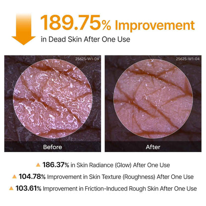 NOVADERM Body Peeling Spray - body peeling spray for glowing skin showing 189.75% improvement in dead skin removal after one use with before and after skin close-ups.
